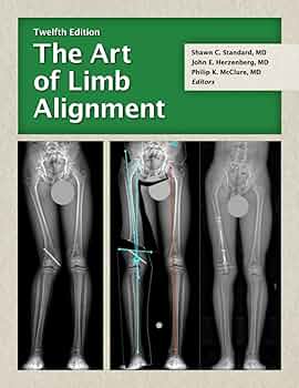 The Art of Limb Alignment, Twelfth Edition: Standard, Shawn C